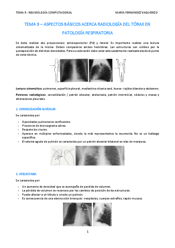 Miniatura del documento TEMA-9-ASPECTOS-BASICOS-ACERCA-RADIOLOGIA-DEL-TORAX-EN-PATOLOGIA-RESPIRATORIA.pdf
