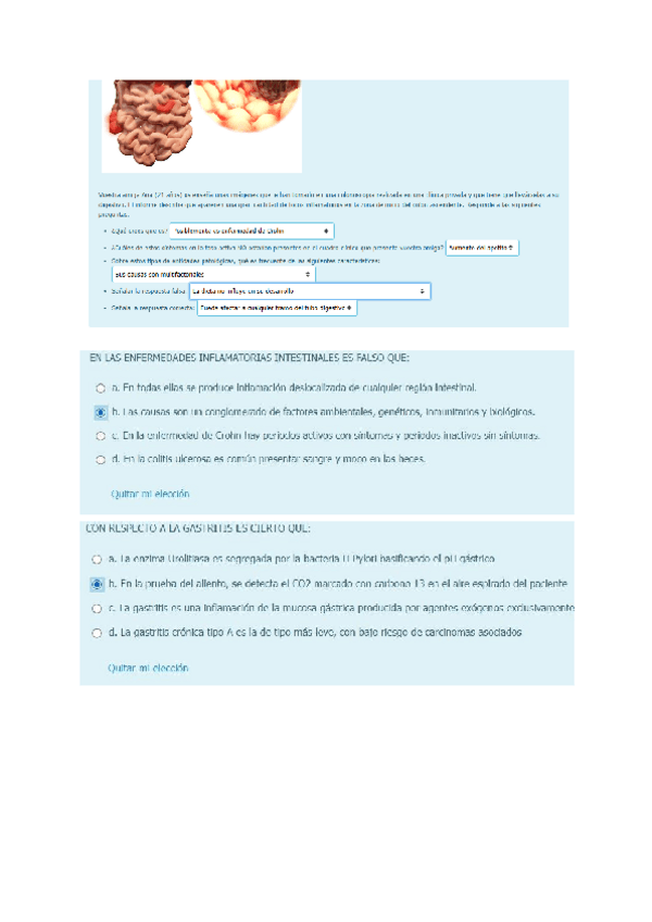 Miniatura del documento TEST-DIGESTIVO.pdf