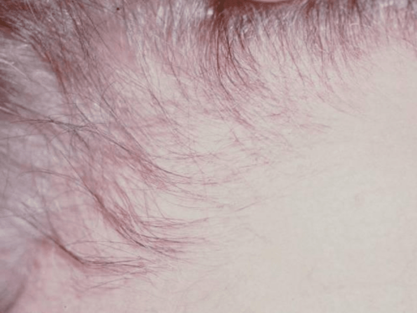 Miniatura del documento Dermatologia-19.pdf