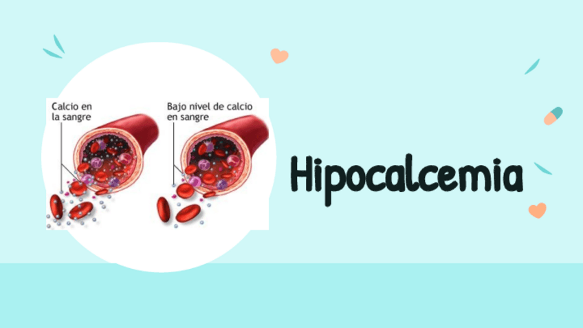 Miniatura del documento Hipocalcemia-3.pdf