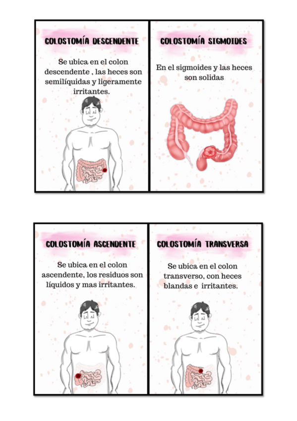 Miniatura del documento anexo-colostomia.pdf