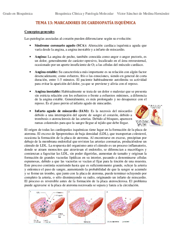 Miniatura del documento Tema 13. Marcadores de cardiopatía isquémica VSM.pdf