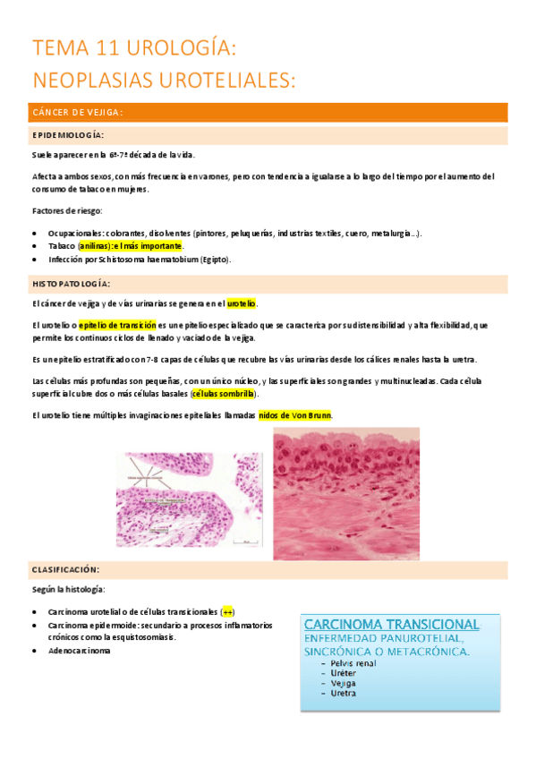 Miniatura del documento 11.-neoplasias-uroteliales.pdf