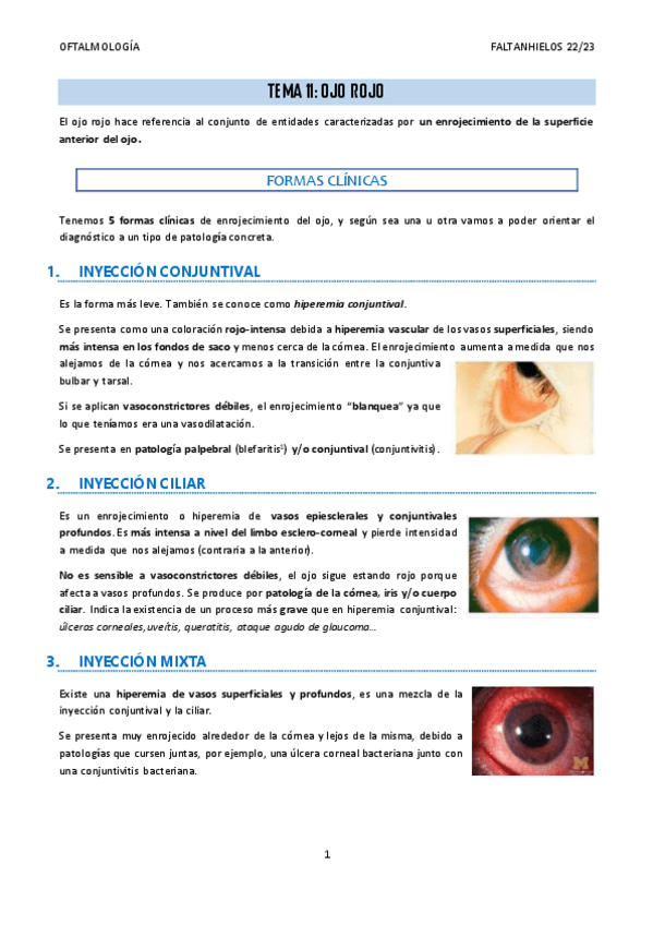 Miniatura del documento 11.-Ojo-rojo.pdf