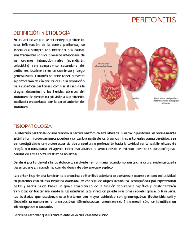 Miniatura del documento PERITONITIS.pdf