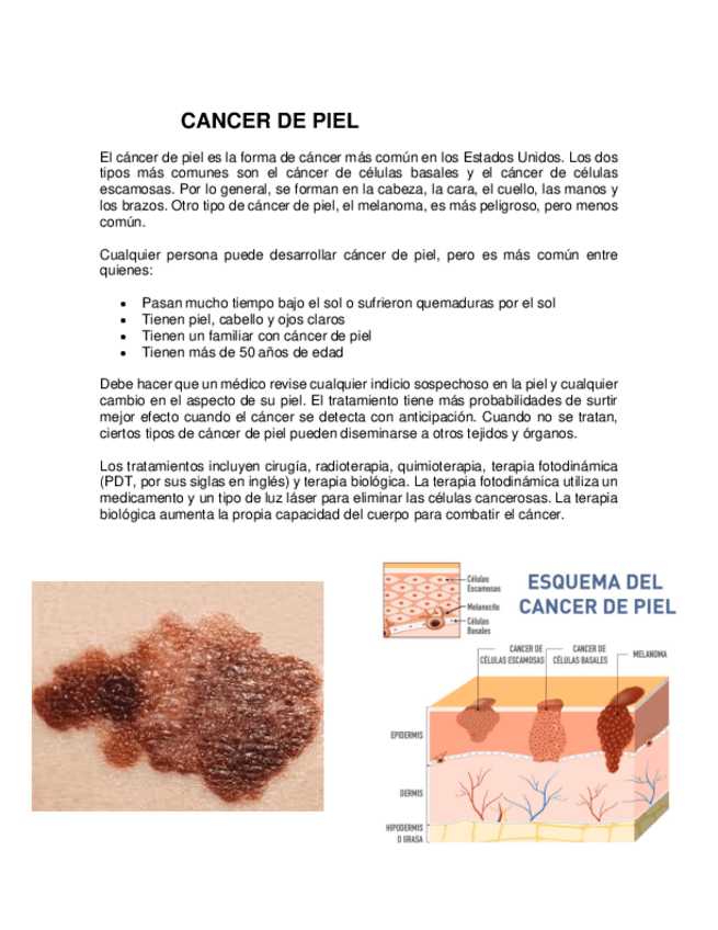 Miniatura del documento CANCER-DE-PIEL.pdf