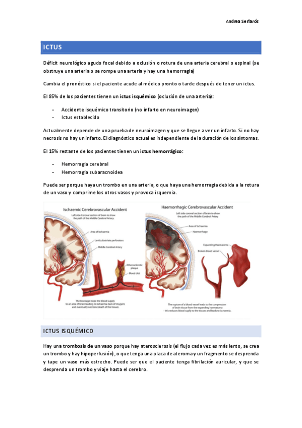 Miniatura del documento Ictus.pdf