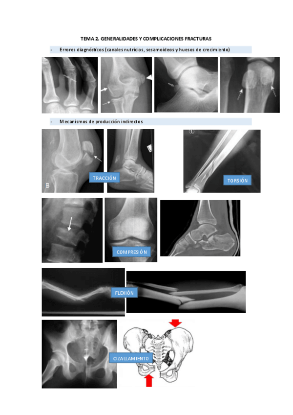 Miniatura del documento Fotos-fracturas-parte-trauma.pdf