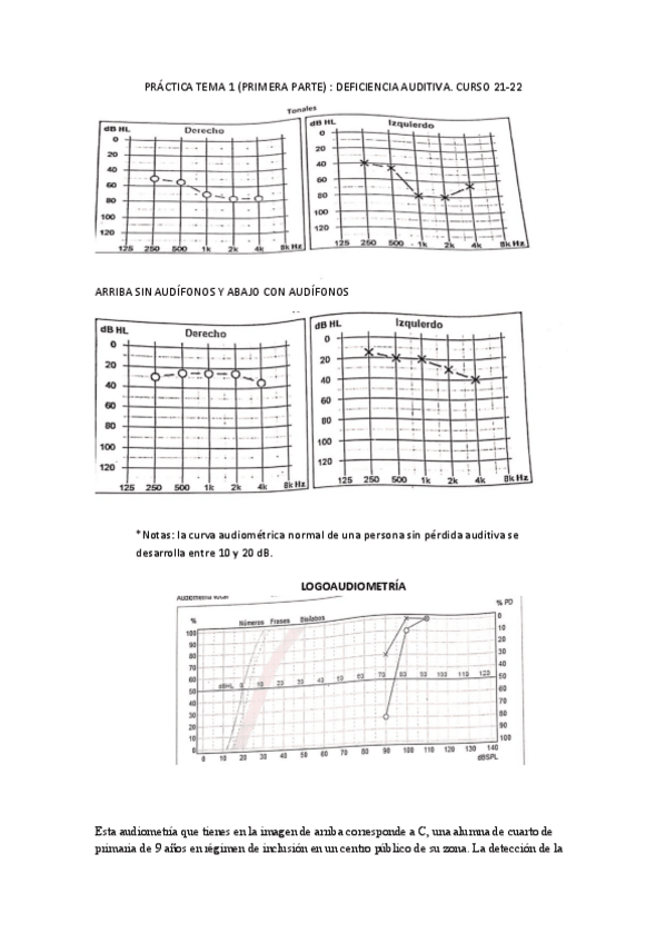 Miniatura del documento actividad-practica-audiometria.pdf