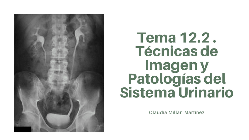 Miniatura del documento Esquema-resumen-Tema-12.2.pdf
