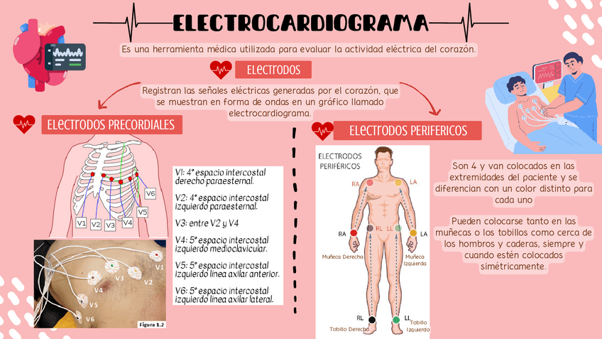 Miniatura del documento ELECTROCARDIOGRAMA-ECG-EKG-RESUMEN-MORFOFISIOLOGIA-1.pdf