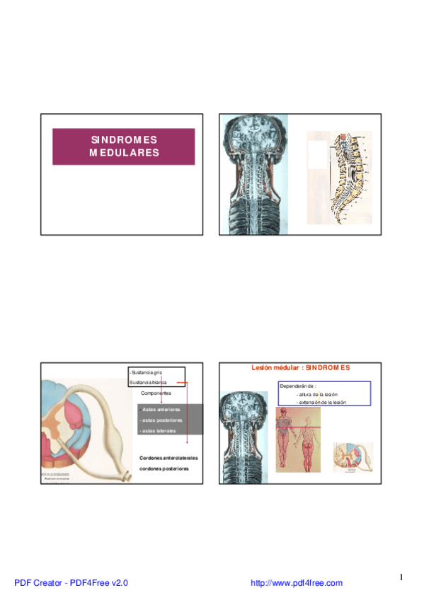Miniatura del documento 7.-SINDROMES-MEDULARES-presentacion.pdf