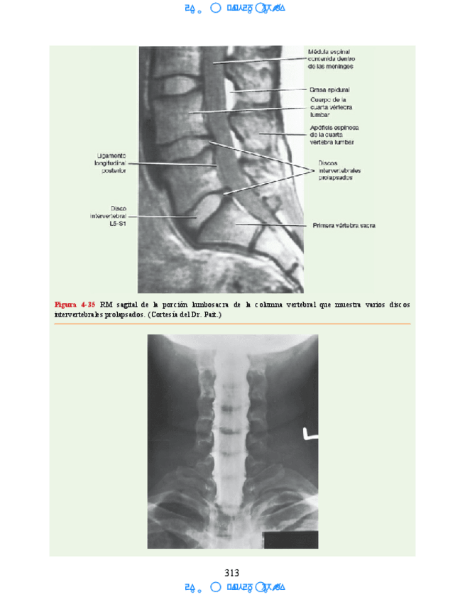 Miniatura del documento Hipocampo-y-hipotalamo-5.pdf