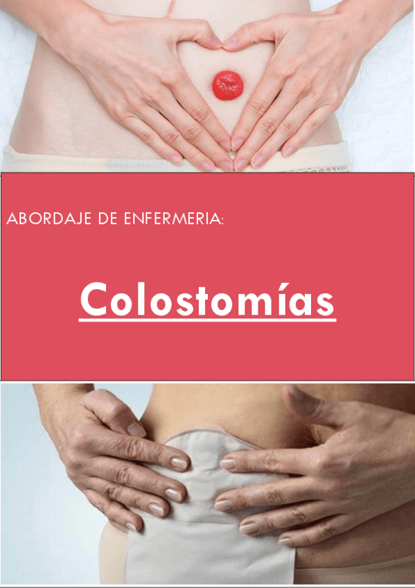 Miniatura del documento COLOSTOMIAS-ENFERMERIA.pdf