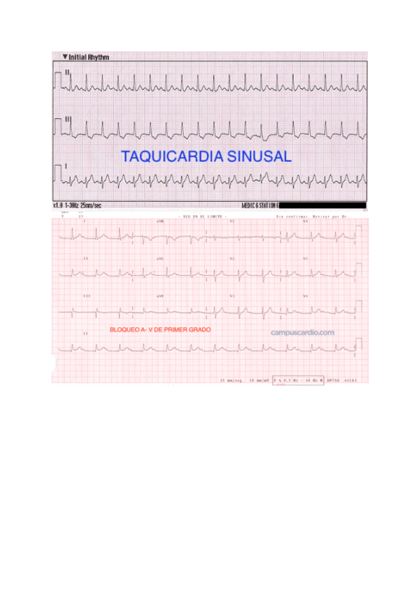 Miniatura del documento Fotos-tipos-ECG.pdf