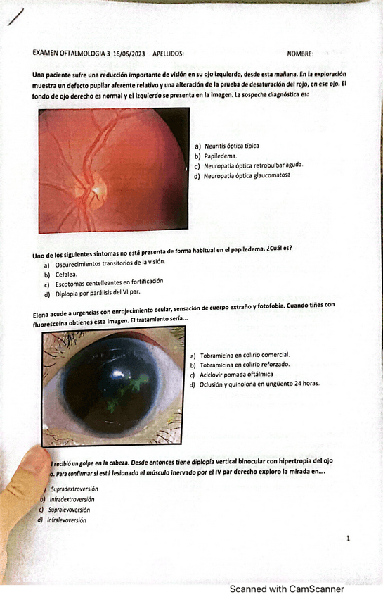 Miniatura del documento Oftalmologia-Junio-2023.pdf