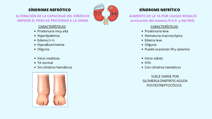 Miniatura del documento SINDROME-NEFROTICO-vs-NEFRITICO-y-tipos-de-calculos-renales.pdf
