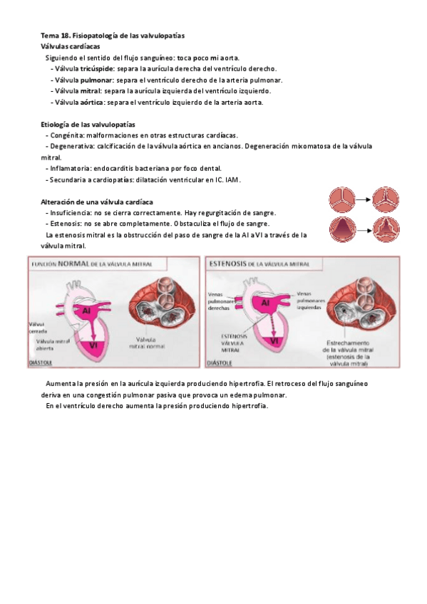 Miniatura del documento Tema-18.-Fisiopatologia-de-las-valvulopatias.pdf
