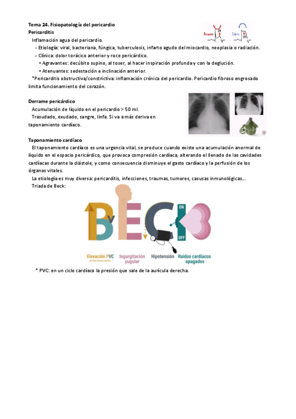 Miniatura del documento Tema-24.-Fisiopatologia-del-pericardio.pdf