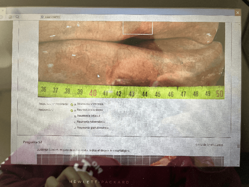 Miniatura del documento EXAMEN-OVINO-2023-JUNIO.pdf