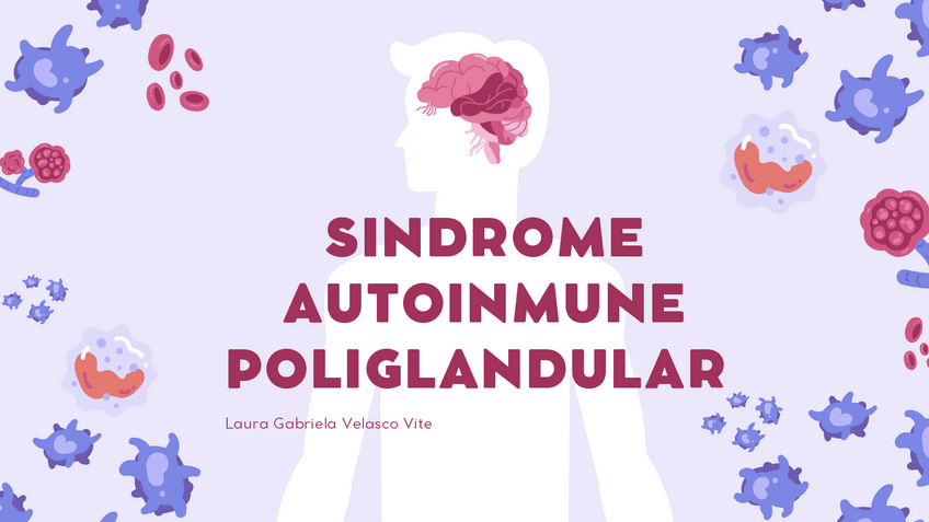 Miniatura del documento Sindrome-autoinmune-poliglandular.pdf