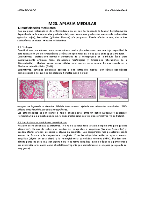 Miniatura del documento M20-Aplasia-medular.docx.pdf