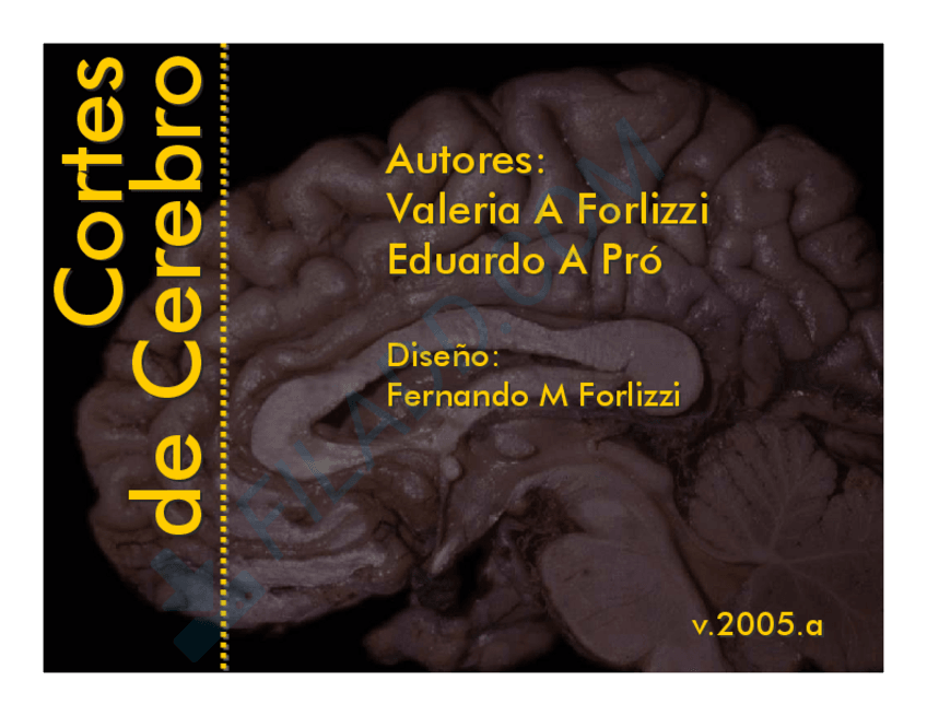 Miniatura del documento Cortes-de-cerebro.pdf