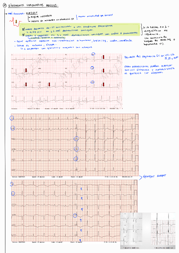 Miniatura del documento Patrones-importantes-ECG.pdf