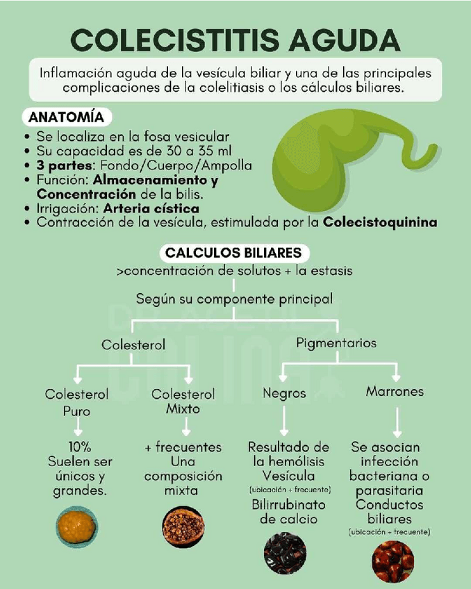 Miniatura del documento colecistitis-aguda-1.pdf