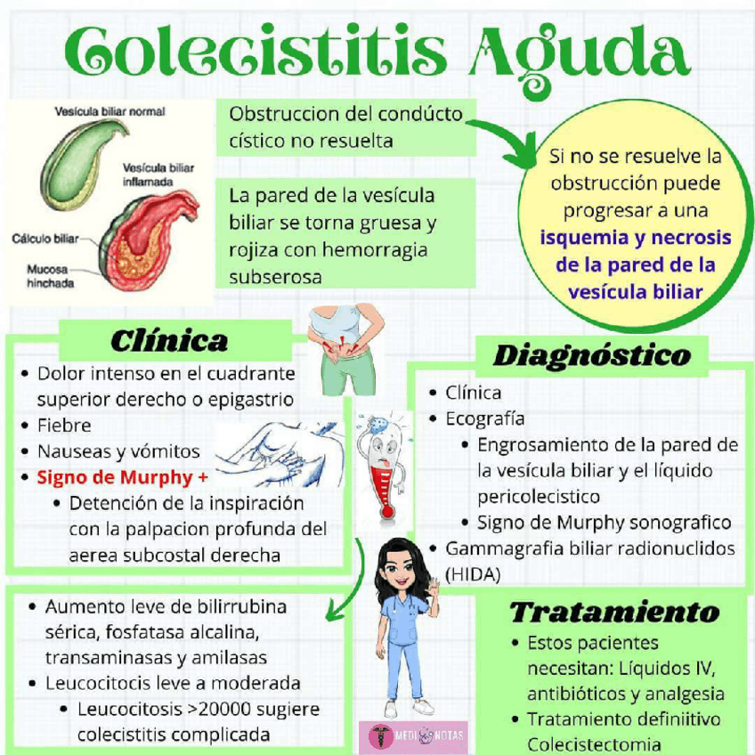 Miniatura del documento COLECISTITIS-AGUDA.pdf
