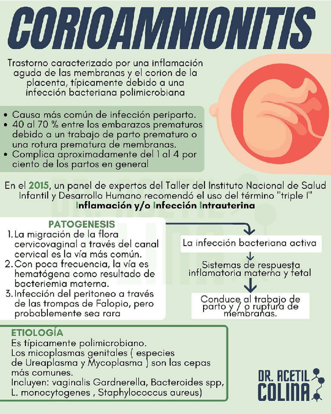 Miniatura del documento CORIOAMNIONITIS.pdf
