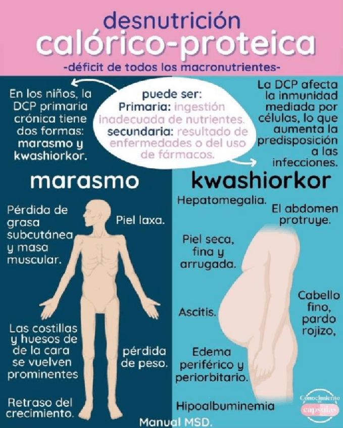 Miniatura del documento DESNUTRICION-CALORICA-PROTEICA.pdf