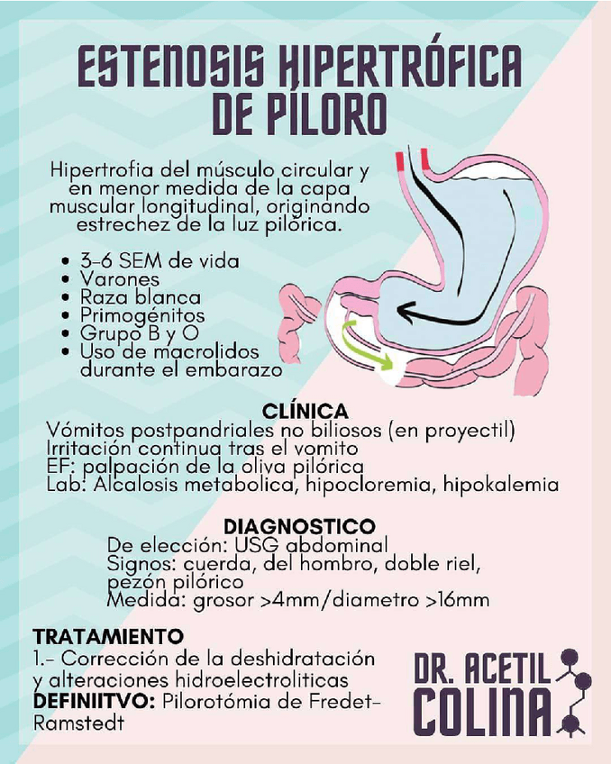 Miniatura del documento Estenosis-Hipertrofica-del-Piloro.pdf