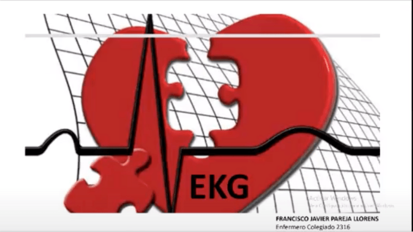 Miniatura del documento ELECTROCARDIOGRAFIA-PACO.pdf