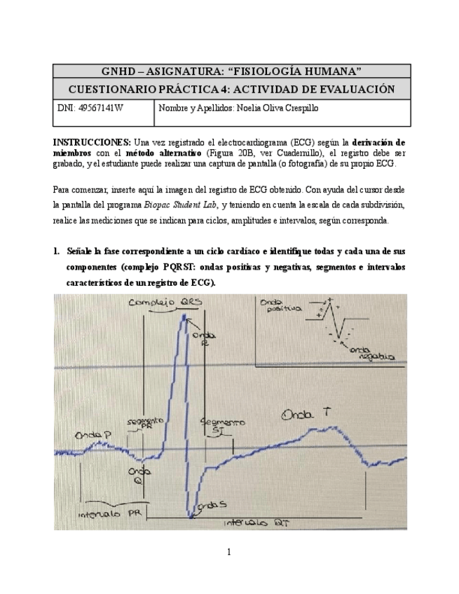 Miniatura del documento Practica-4-FH-ECG-Cuestionario.pdf