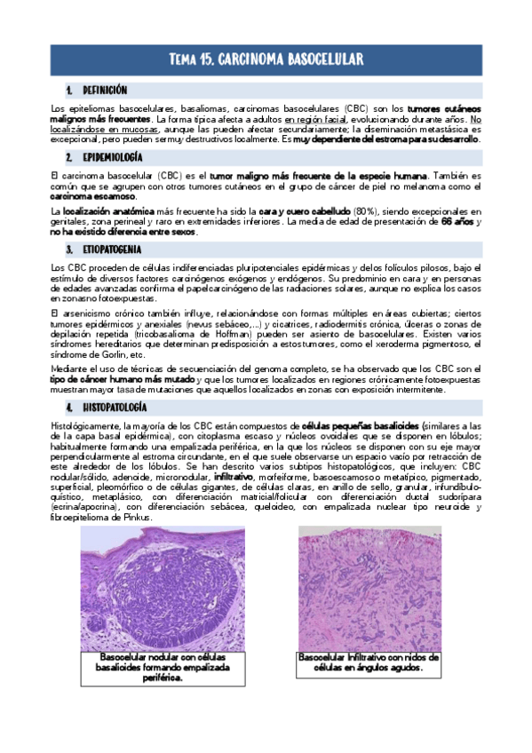 Miniatura del documento Tema-15.-Carcinoma-Basocelular.pdf
