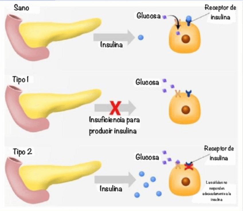 Miniatura del documento Imagen-diabetes.pdf