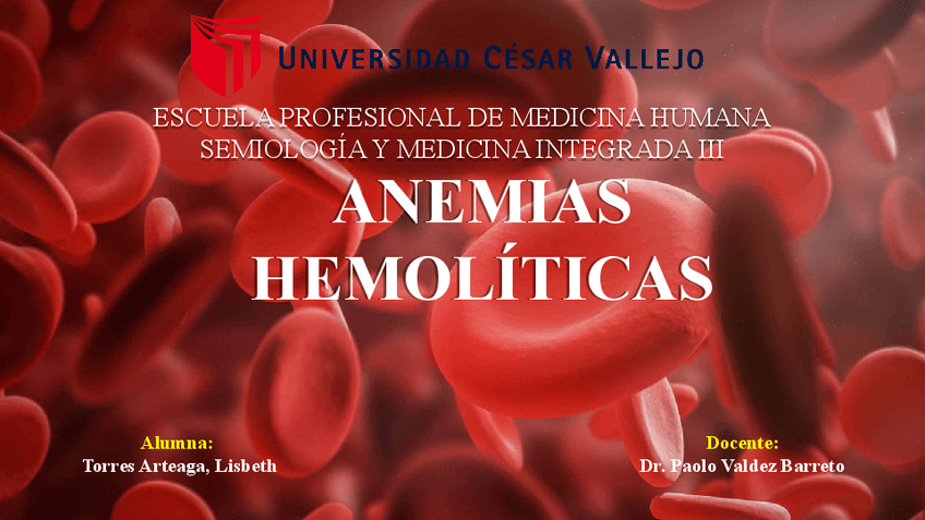 Miniatura del documento Anemia-hemolitica.pdf