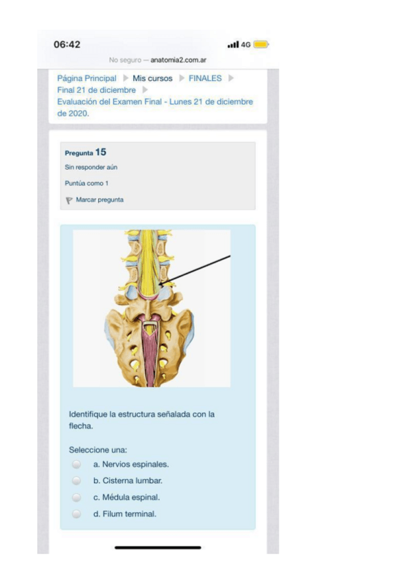 Miniatura del documento CHOICES-ANATO-PATO-9.pdf