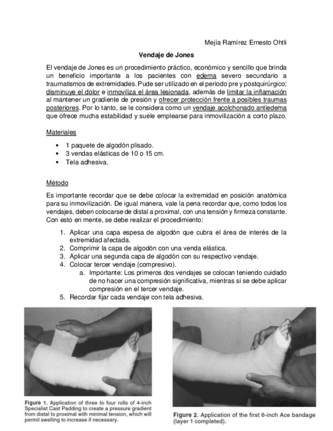 Miniatura del documento Vendaje-de-Jones.pdf