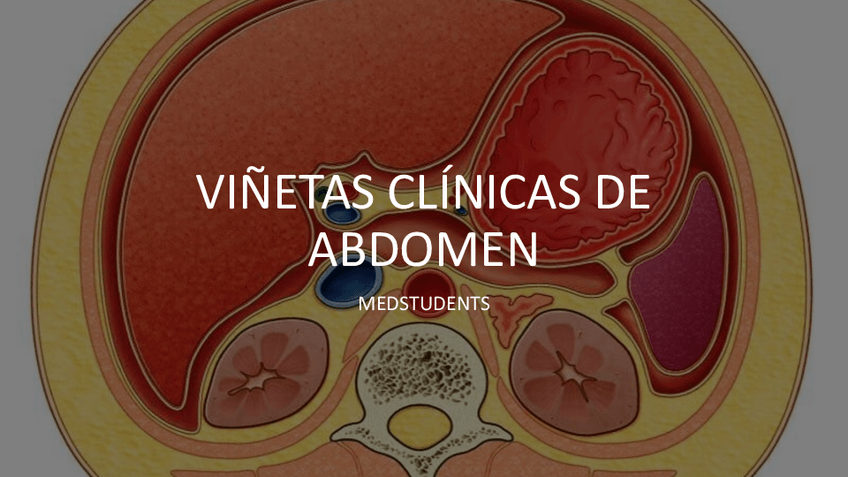 Miniatura del documento VINETAS-CLINICAS-DE-ABDOMEN.pptx.pdf