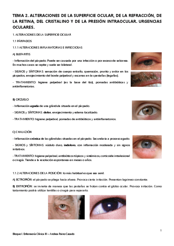 Miniatura del documento Tema-2.-Alteraciones-de-la-superficie-ocular-de-la-refraccion-de-la-retina.pdf