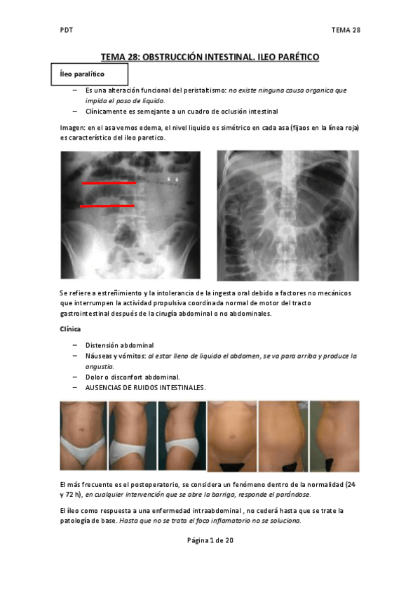Miniatura del documento TEMA-28-DEF.pdf