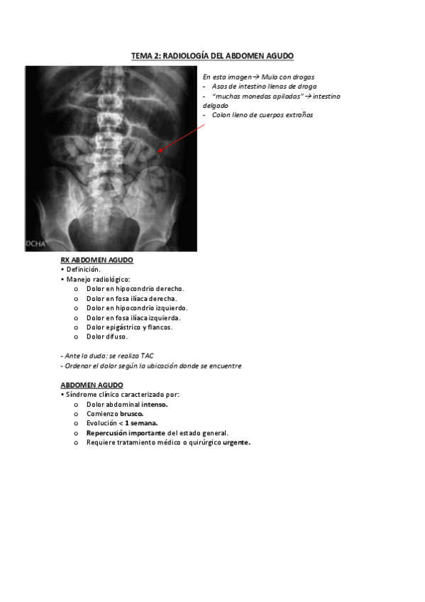 Miniatura del documento TEMA-2-RAYOS-ABDOMEN-AGUDO..pdf