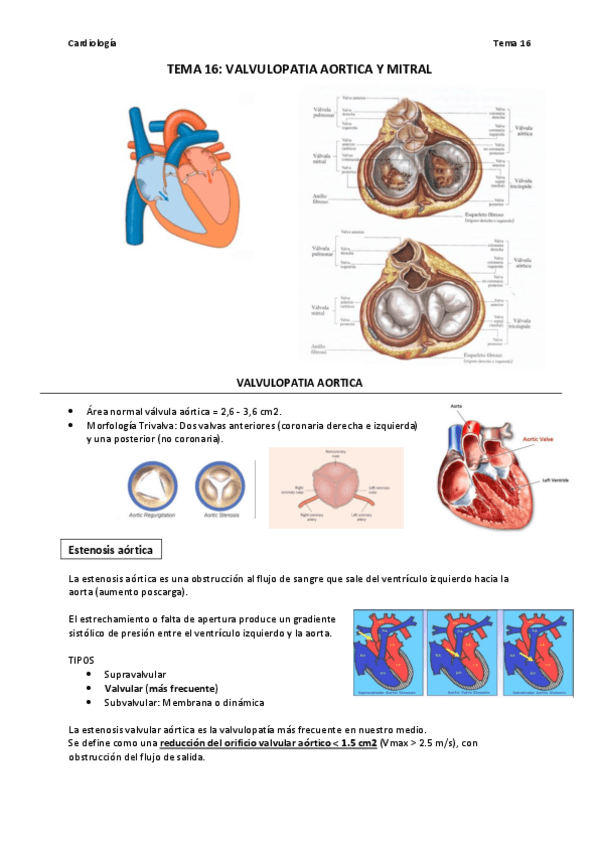 Miniatura del documento TEMA-16-VALVULOPATIA-AORTICA-Y-MITRAL.pdf