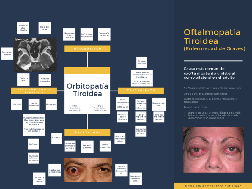 Miniatura del documento Enfermedad-de-Graves-Oftalmopatia-Tiroidea.pdf