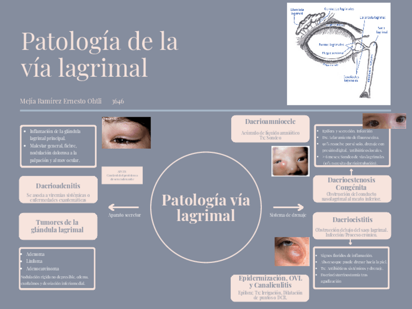 Miniatura del documento Patologia-de-la-via-lagrimal.pdf