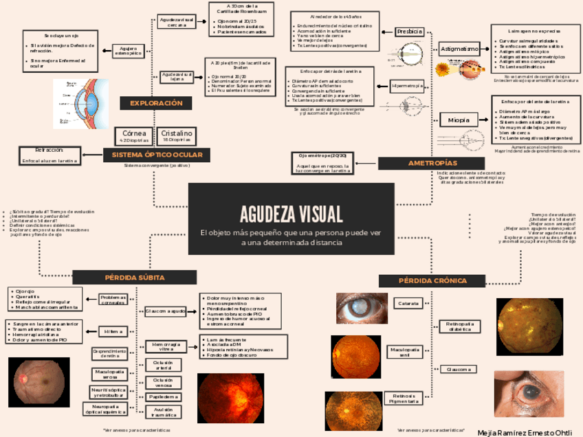 Miniatura del documento Agudeza-visual-Perdida-de-la-vision-y-Ametropias.pdf