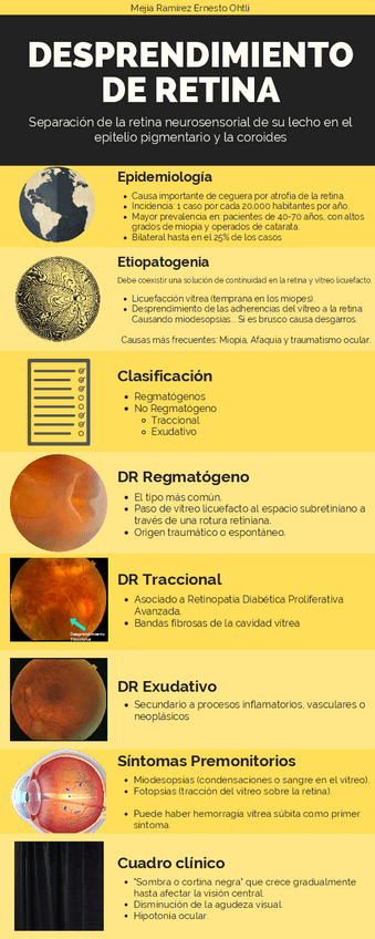 Miniatura del documento Desprendimiento-de-Retina.pdf
