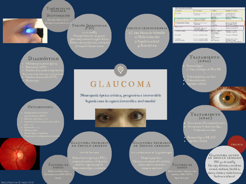 Miniatura del documento Glaucoma-Oftalmo.pdf